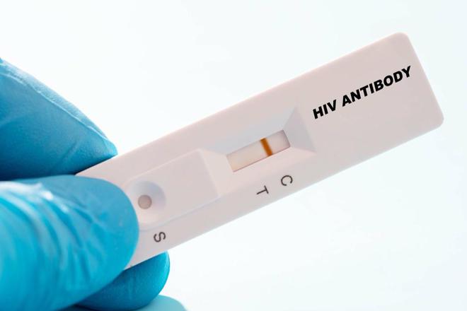 公共场所接触用过的HIV试剂盒!疾控专家:体外病毒活性弱,感染风险很小(1) 公共场所接触用过的HIV试剂盒!疾控专家:体外病毒活性弱,感染风险很小(1)